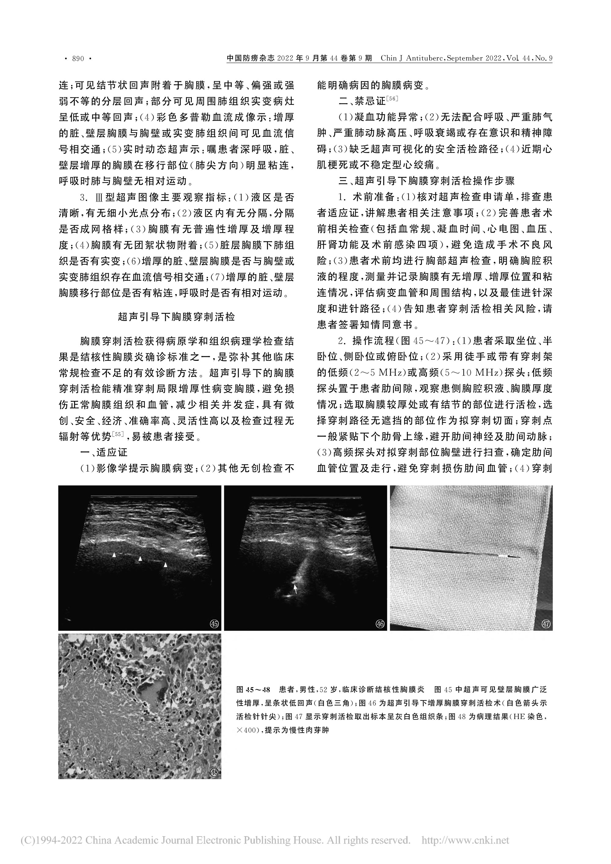 2022結(jié)核性胸膜炎超聲診斷、分型及介入治療專家共識(shí)(2022年版)-11.jpg