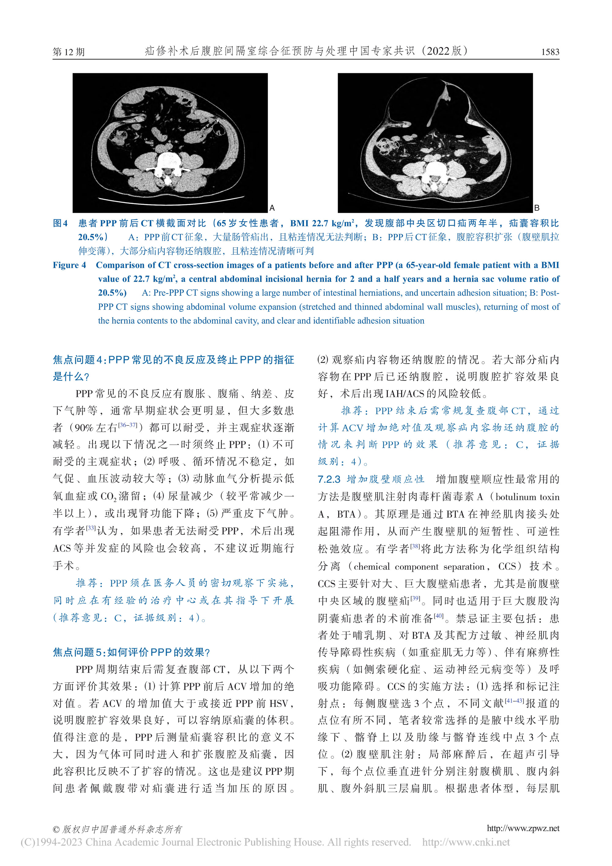 2022-疝修補術后腹腔間隔室綜合征預防與處理中國專家共識-6.jpg